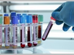 山东干细胞储存项目代理_专业可靠的干细胞储存项目元生源生物科